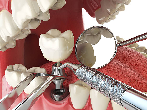 Best Emergency Treatment for Toothache in Manhattan, NY